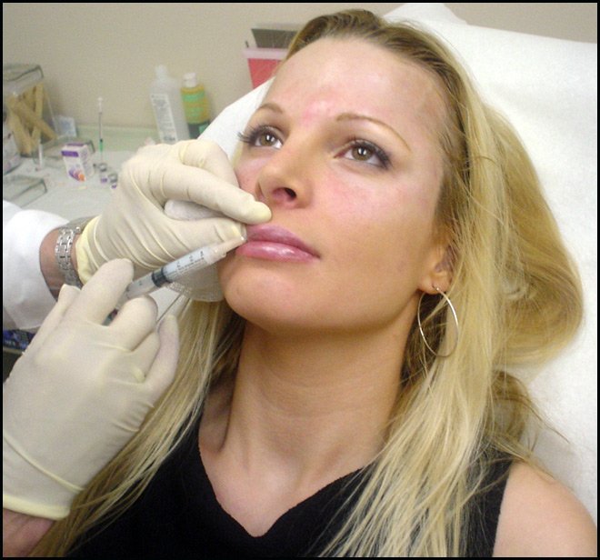 Comment prolonger la jeunesse de la peau