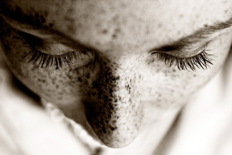 Pigmentation de la peau et principaux ingrédients blanchissants