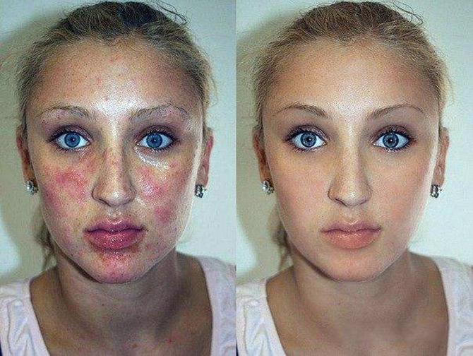 Photoshop et beauté