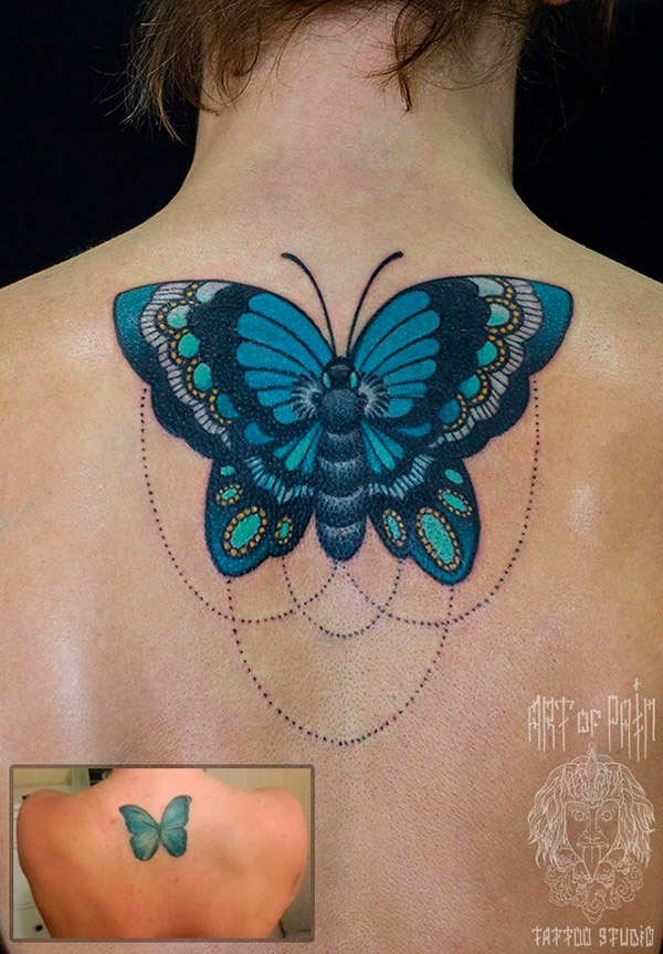 Détatouage au laser - à quoi se préparer