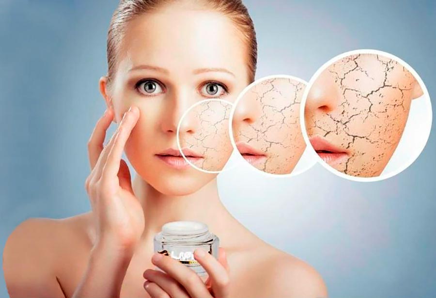 Peau sèche et déshydratée